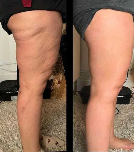Image de resultat client du Legging Lyvenya