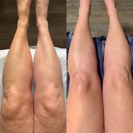 Image de resultat client