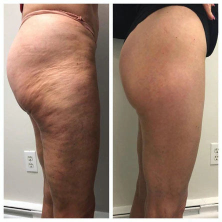 Exemple de resultat client